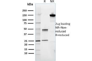 SDS-PAGE Analysis Purified ROR2 Mouse Monoclonal Antibody (ROR2/1911). (ROR2 antibody)