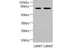 Western blot All lanes: ARMC9 antibody at 6 μg/mL Lane 1: Jurkat whole cell lysate Lane 2: CEM whole cell lysate Secondary Goat polyclonal to rabbit IgG at 1/10000 dilution Predicted band size: 92, 76 kDa Observed band size: 76 kDa (ARMC9 antibody  (AA 401-665))