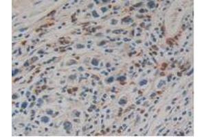 Figure. (Kallikrein 10 antibody  (AA 35-276))