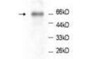 Image no. 1 for anti-Intercellular Adhesion Molecule 1 (ICAM1) (AA 301-532) antibody (ABIN791495) (ICAM1 antibody  (AA 301-532))