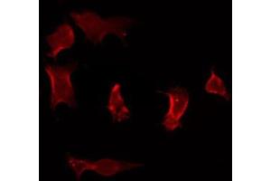 ABIN6275919 staining Hela by IF/ICC. (CCR7 antibody  (Internal Region))