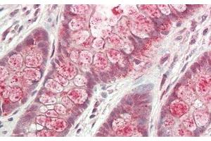 Immunohistochemistry (IHC) image for anti-Galactosidase, alpha (GLA) (AA 81-429) antibody (ABIN7431278)