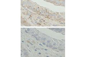 Immunohistochemistry on Formalin-fixed and paraffin-embedded human prostate tissue. (HSD17B10 antibody  (C-Term))