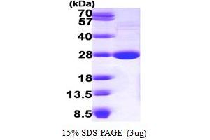 SDS-PAGE (SDS) image for Lysophospholipase I (LYPLA1) (AA 1-230) protein (His tag) (ABIN667215) (LYPLA1 Protein (AA 1-230) (His tag))