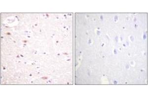 Immunohistochemistry analysis of paraffin-embedded human brain, using CDC16/APC6 (Phospho-Ser560) Antibody. (CDC16 antibody  (pSer560))