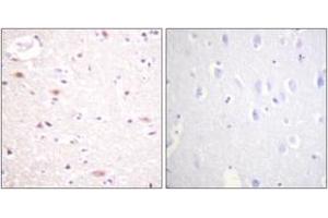 Immunohistochemistry analysis of paraffin-embedded human brain, using CDC16/APC6 (Phospho-Ser560) Antibody.