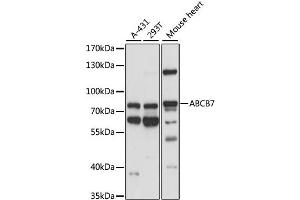 Western blot analysis of extracts of various cell lines, using ABCB7 antibody. (ABCB7 antibody)