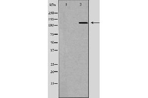 Western blot analysis of Hela whole cell lysates, using IPO5 Antibody. (Importin 5 antibody)