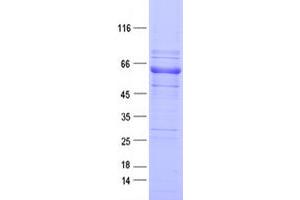 Validation with Western Blot