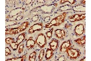 Immunohistochemistry of paraffin-embedded human kidney tissue using ABIN7156336 at dilution of 1:100 (IRS2 antibody  (AA 766-1001))