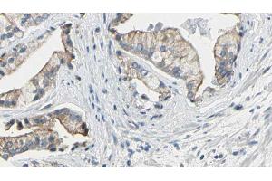 ABIN6272608 at 1/100 staining Human prostate tissue by IHC-P. (NPR1 antibody  (Internal Region))