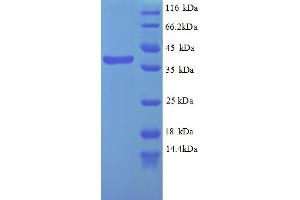 SDS-PAGE (SDS) image for Wilms Tumor 1 (WT1) (AA 147-446), (partial) protein (His tag) (ABIN5712782) (WT1 Protein (AA 147-446, partial) (His tag))