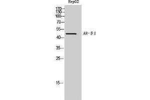 Western Blotting (WB) image for anti-Androgen Receptor beta 2 (C-Term) antibody (ABIN3173911) (Androgen Receptor beta 2 antibody  (C-Term))