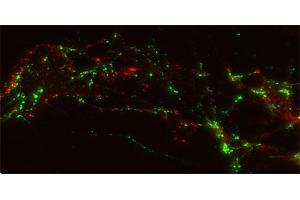 Immunocytochemistry (ICC) image for anti-Solute Carrier Family 1 (Neuronal/epithelial High Affinity Glutamate Transporter, System Xag), Member 1 (SLC1A1) (AA 487-500), (Cytoplasmic Domain) antibody (ABIN1742507)