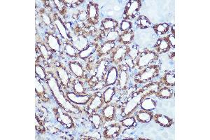 Immunohistochemistry of paraffin-embedded mouse kidney using HK1 Rabbit mAb (ABIN7267638) at dilution of 1:100 (40x lens). (Hexokinase 1 antibody)