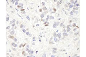 anti-Melanoma Antigen Family D, 2 (MAGED2) (AA 1-50) antibody