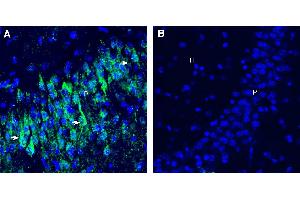 Expression of CD9 in mouse hippocampus. (CD9 antibody  (Extracellular))