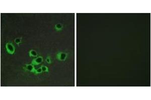 Immunofluorescence analysis of COS7 cells, using HTR2B Antibody. (Serotonin Receptor 2B antibody  (AA 15-64))