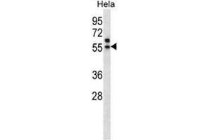 TADA3L Antibody (C-term) western blot analysis in Hela cell line lysates (35µg/lane).