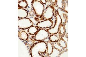 MPP7 antibody  (N-Term)