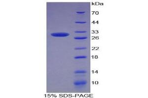 SDS-PAGE (SDS) image for Superoxide Dismutase 3, Extracellular (SOD3) (AA 16-244) protein (His tag) (ABIN1879789) (SOD3 Protein (AA 16-244) (His tag))