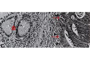 Image no. 1 for anti-4-Hydroxynonenal (HNE) antibody (ABIN335414) (HNE antibody)