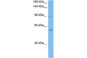 Host:  Mouse  Target Name:  NFATC4  Sample Tissue:  Mouse Pancreas  Antibody Dilution:  1ug/ml (NFATC4 antibody  (N-Term))