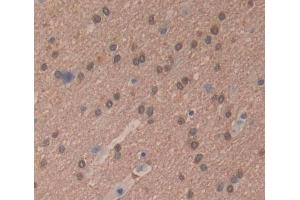 Used in DAB staining on fromalin fixed paraffin- embedded brain tissue (RNASEH2A antibody  (AA 1-299))