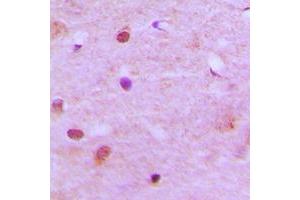 Immunohistochemical analysis of RCC2 staining in human brain formalin fixed paraffin embedded tissue section. (RCC2 antibody  (C-Term))