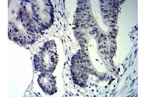 Immunohistochemistry (IHC) image for anti-Cyclin-Dependent Kinase Inhibitor 1C (p57, Kip2) (CDKN1C) antibody (ABIN7193626)