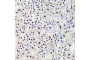 Immunohistochemistry of paraffin-embedded mouse kidney using SF3B3/S Rabbit mAb (ABIN7270544) at dilution of 1:100 (40x lens). (SF3B3 antibody)