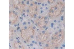 Used in DAB staining on fromalin fixed paraffin- embedded Kidney tissue (Nicotinamide Adenine Dinucleotide Phosphate Oxidase 3 (AA 221-466) antibody)