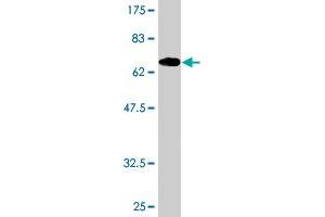 Western Blot detection against Immunogen (69. (ADRM1 antibody  (AA 18-407))
