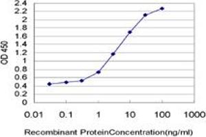 anti-Membrane-Associated Ring Finger (C3HC4) 7, E3 Ubiquitin Protein Ligase (MARCH7) (AA 66-136) antibody