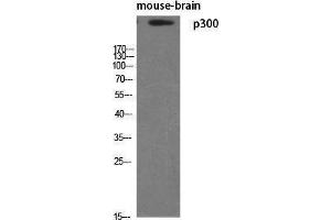 Western Blotting (WB) image for anti-E1A Binding Protein P300 (EP300) (N-Term) antibody (ABIN3186253) (p300 antibody  (N-Term))