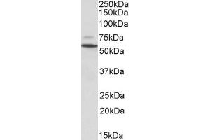 (ABIN2613465) (0. (Peripherin antibody  (C-Term))