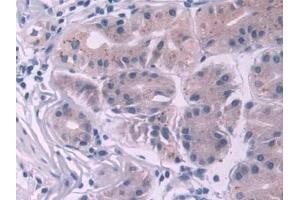 DAB staining on IHC-P; Samples: Human Stomach Tissue (NOTCH2NL antibody  (AA 1-236))