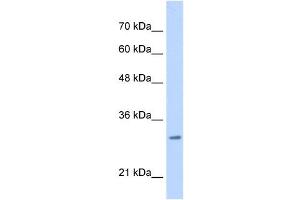 MLF2 antibody used at 0. (MLF2 antibody  (C-Term))
