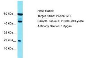 Image no. 1 for anti-Phospholipase A2, Group XIIB (PLA2G12B) (N-Term) antibody (ABIN6750703) (PLA2G12B antibody  (N-Term))