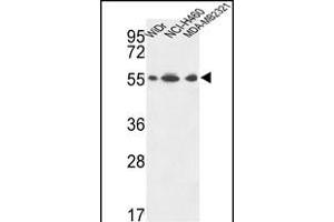 ATP5A1 Antibody (C-term) (ABIN653734 and ABIN2843039) western blot analysis in WiDr,NCI-,MDA-M cell line lysates (35 μg/lane). (ATP5A1 antibody  (C-Term))