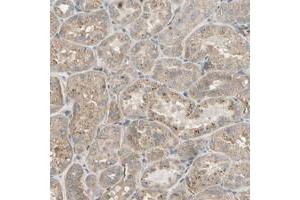 Immunohistochemical staining of human kidney with ZP4 polyclonal antibody  shows moderate cytoplasmic positivity in cells in tubules at 1:200-1:500 dilution. (ZP4 antibody)