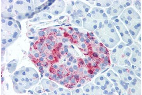 WNT10A antibody  (Internal Region)