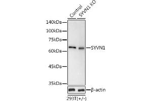 Western blot analysis of extracts from normal (control) and SYVN1 knockout (KO) 293T cells, using SYVN1 antibody (ABIN1680347, ABIN3016314, ABIN3016315 and ABIN6219717) at 1:1000 dilution.