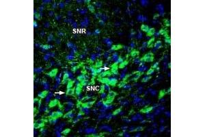 Expression of TRPM2 in rat substantia nigra - Immunohistochemical staining of perfusion-fixed frozen rat brain sections with Anti-TRPM2 (extracellular) Antibody (ABIN7043831, ABIN7044075 and ABIN7044076), followed by goat anti-rabbit-AlexaFluor-488. (TRPM2 antibody  (3rd Extracellular Loop))