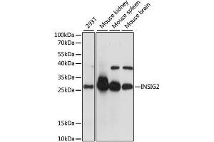 Western blot analysis of extracts of various cell lines, using INSIG2 antibody (ABIN6291415) at 1:1000 dilution. (INSIG2 antibody)
