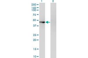 Western Blot analysis of PHKG2 expression in transfected 293T cell line by PHKG2 monoclonal antibody (M04), clone 2F4. (PHKG2 antibody  (AA 1-406))