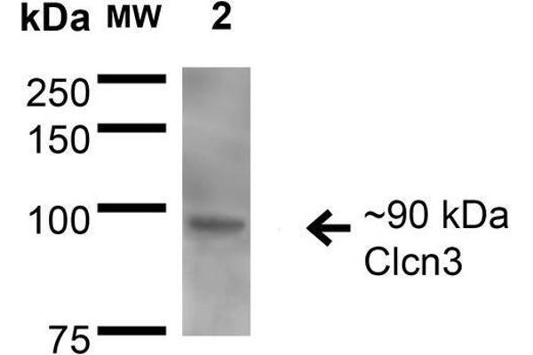 CLCN3 antibody  (AA 98-115)