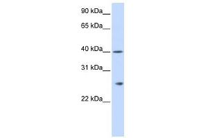 GSTK1 antibody used at 1 ug/ml to detect target protein. (GSTK1 antibody  (N-Term))