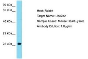 Image no. 1 for anti-Ubiquitin-Conjugating Enzyme E2E 2 (UBE2E2) (N-Term) antibody (ABIN6750311) (UBE2E2 antibody  (N-Term))