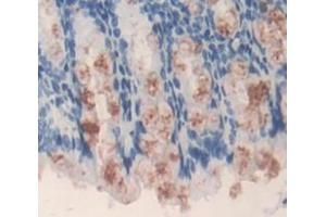 Figure. (ACAT1 antibody  (AA 31-424))